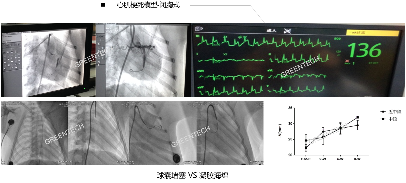 球囊堵塞VS凝胶海绵 心肌梗死模型