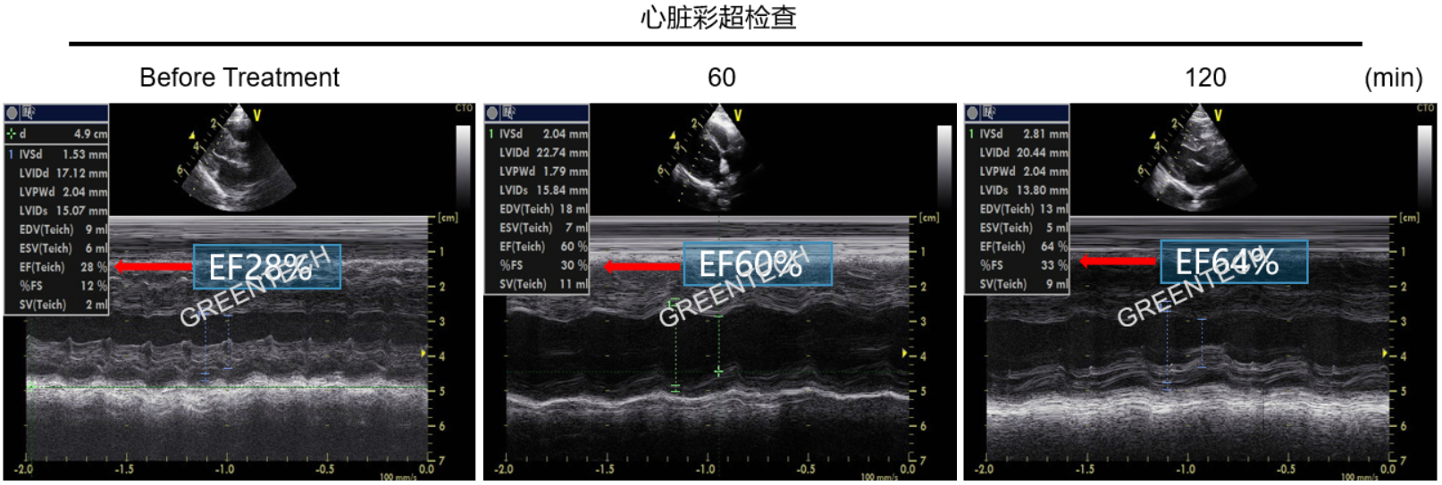 *药物在恒河猴快速起搏模型中的应用