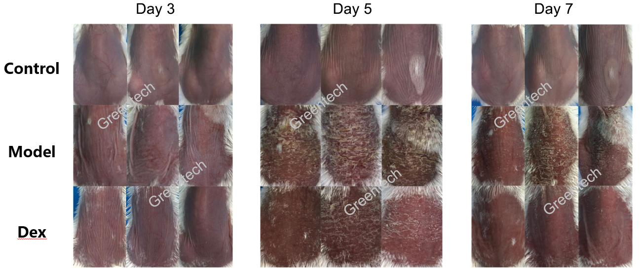 IMQ-induced psoriasis mouse model.png