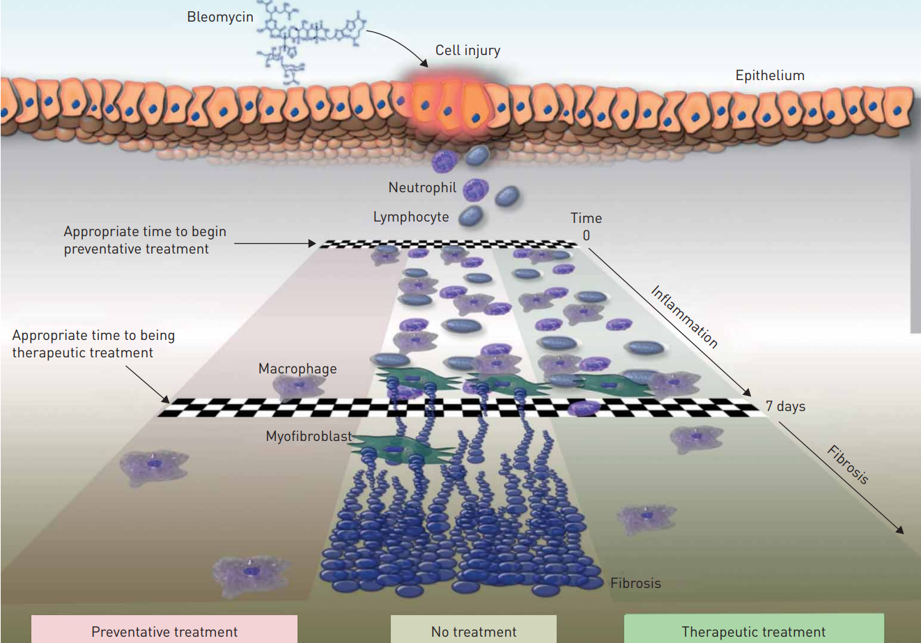 Illustration of the appropriate times to start intervention in the model of bleomycin induced pulmonary fibrosis.png