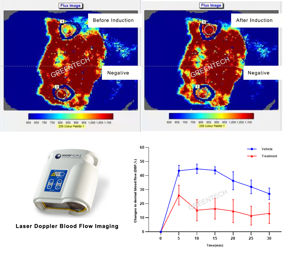 Skin blood flow changes after topical administration of capsaicin.png