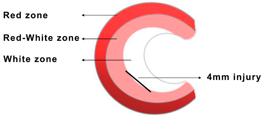 Diagram demonstrating the meniscal injury in rabbits.png